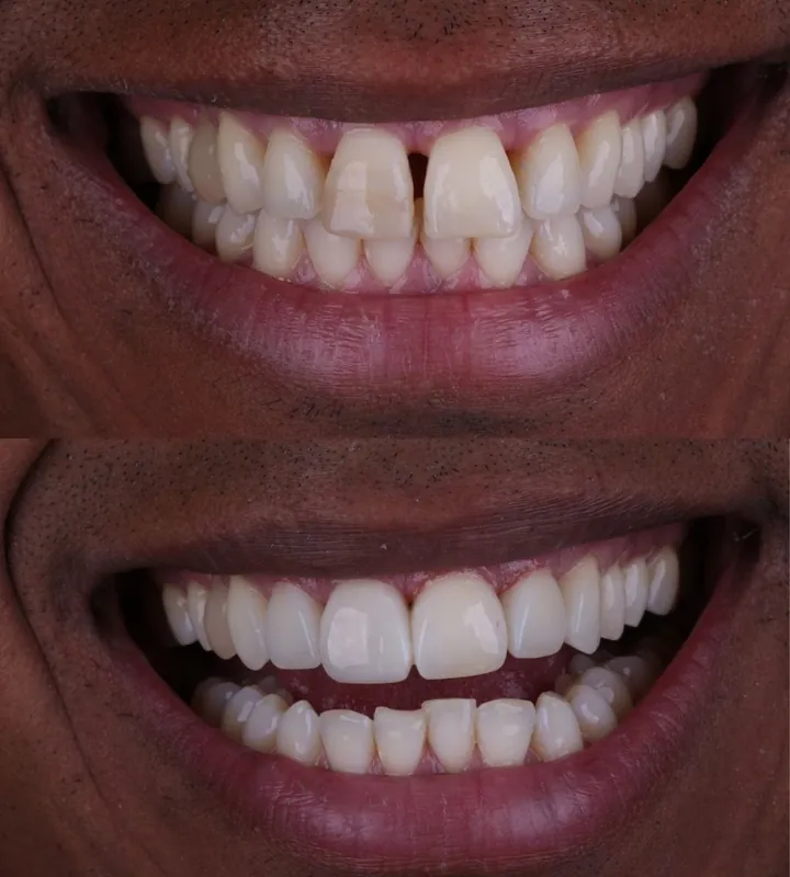 Antes e depois — caso 2
